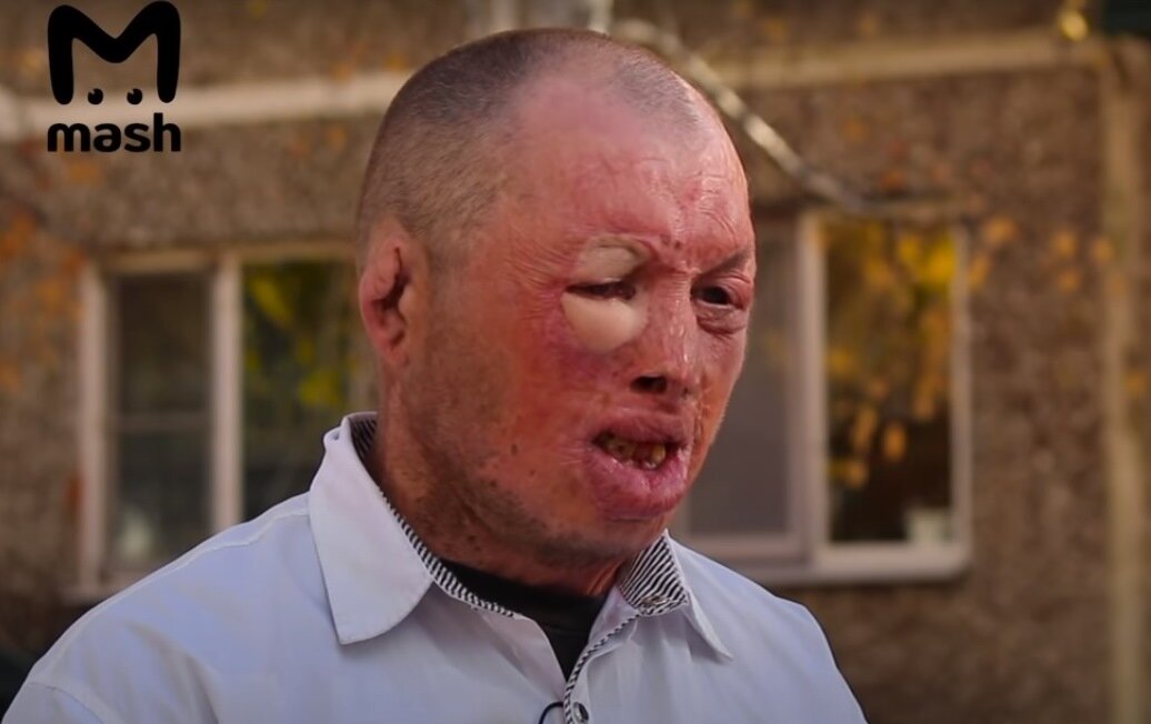 Кадр из фильма MASH