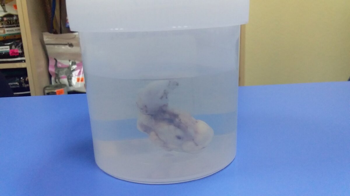 это образование удалили у Милы из брюшной полости