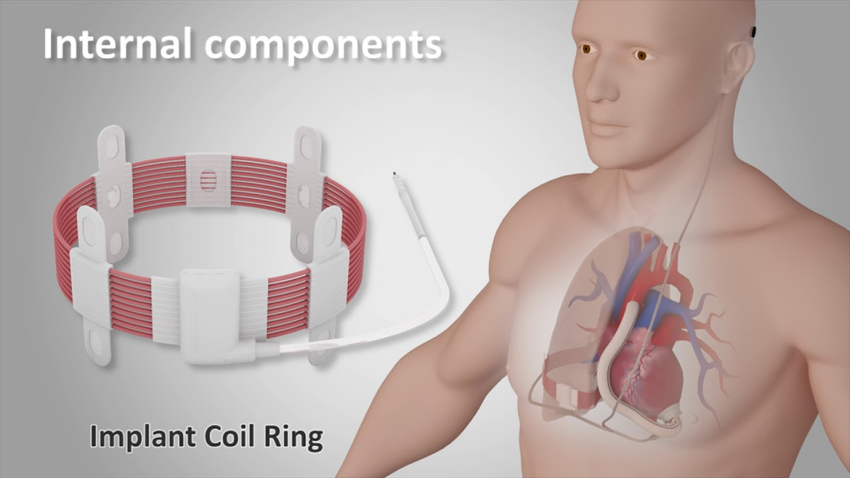 Сердечный насос с беспроводным питанием 