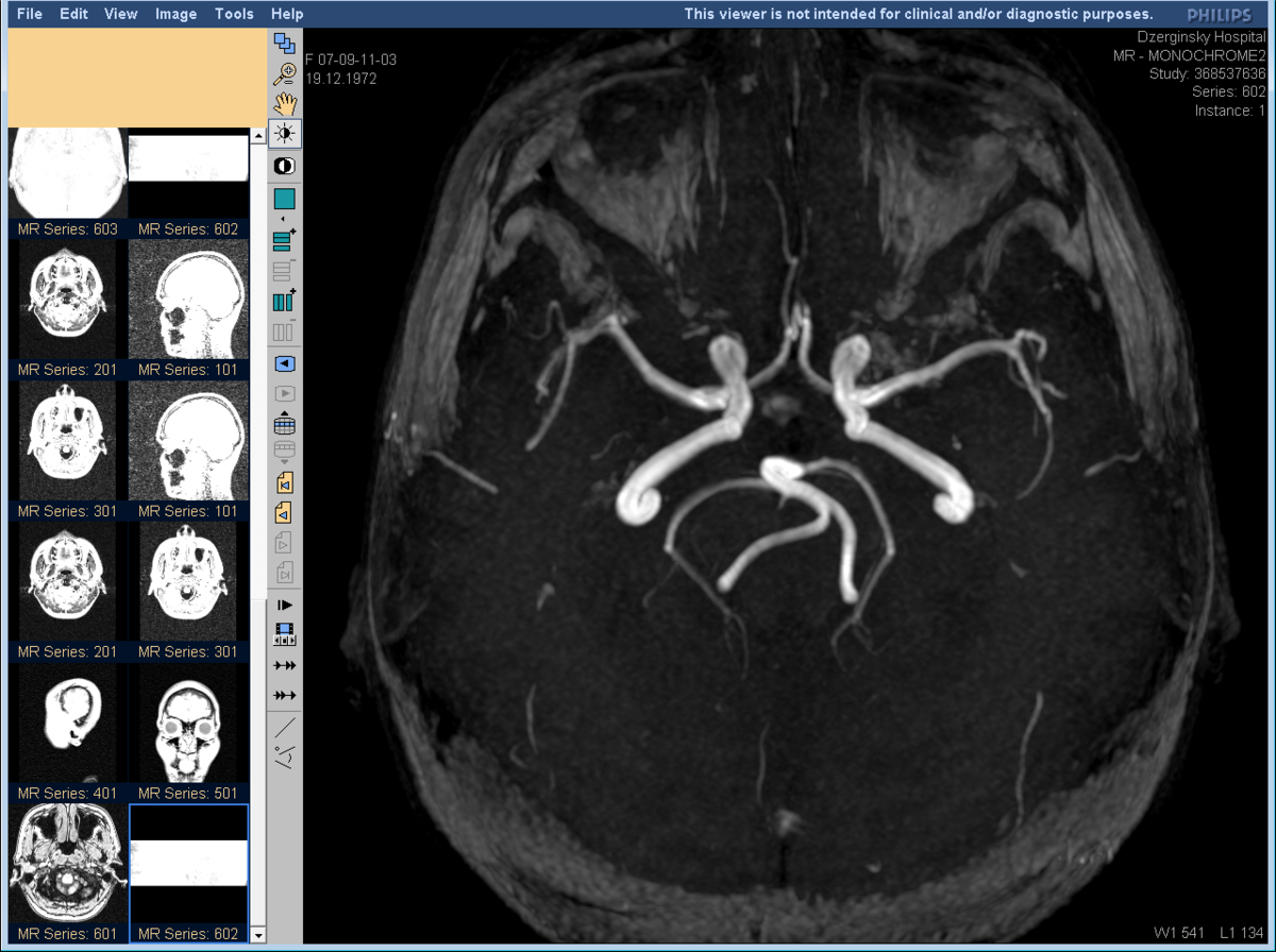 Мрт с контрастированием головного. Кт (компьютерная томография) сосудов головного мозга. Магнитно-резонансная ангиография мозга. Мрт головного мозга и ангиография. Мрт головного мозга ангиография с контрастированием.