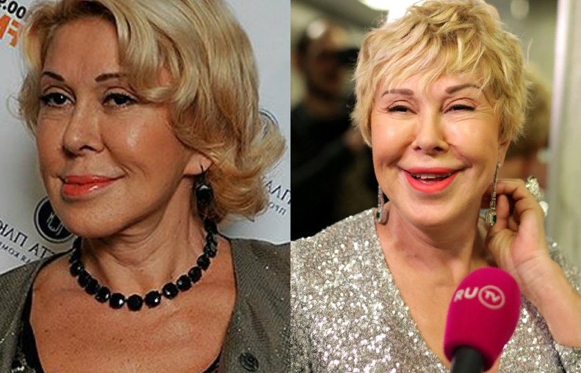 Любовь Успенская и ее пластические операции: фото