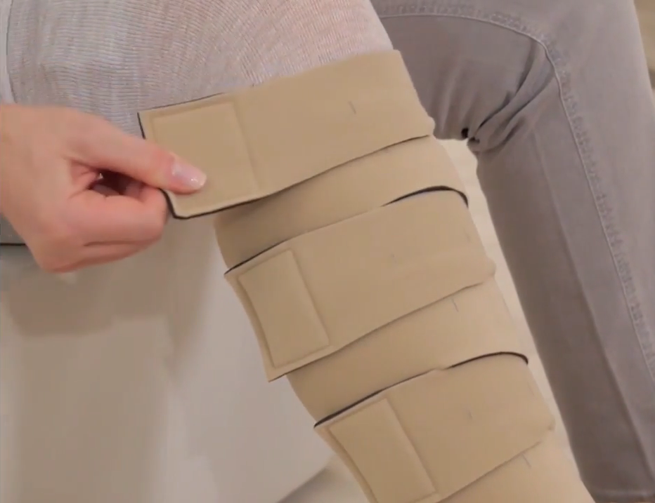 Регулируемый бандаж Циркейд не только эффективно сдерживает отек, но и помогает его уменьшить.