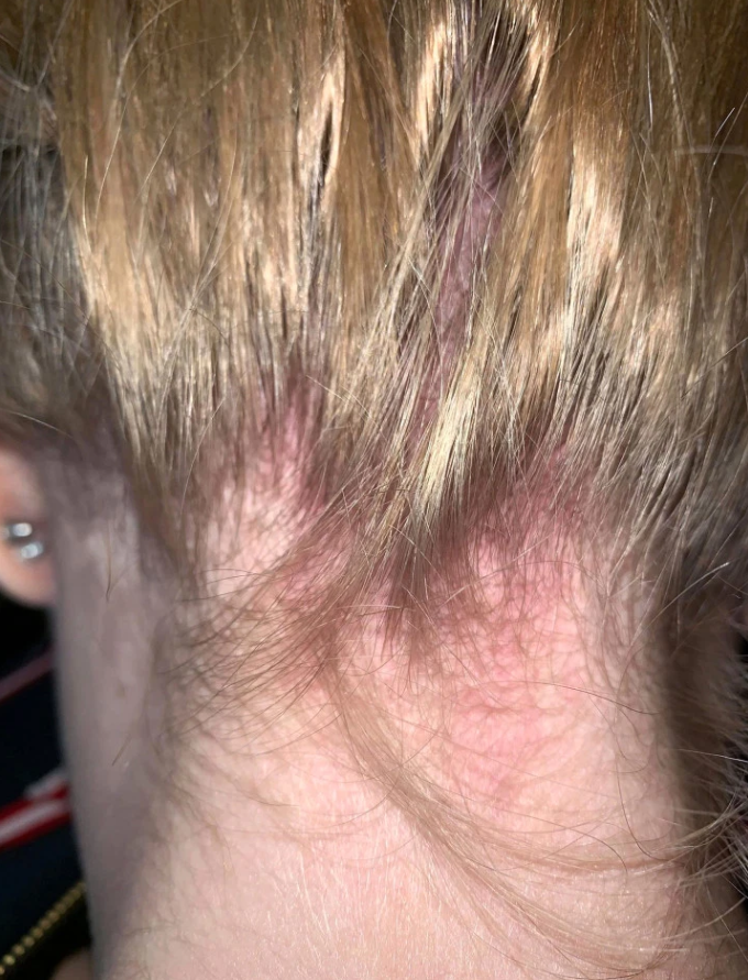 Фото The Irish Sun