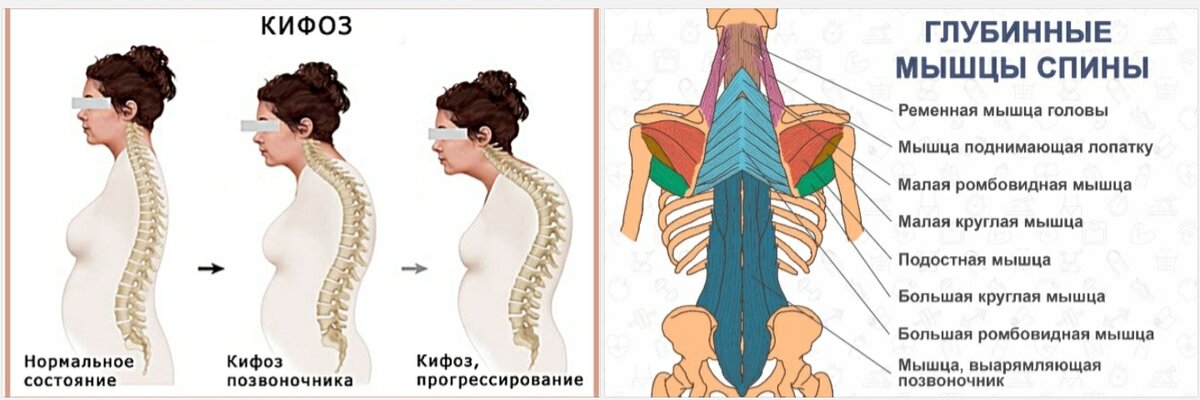 Как вправить позвоночник и отдельные позвонки при смещении самому. Клиника Бобыря