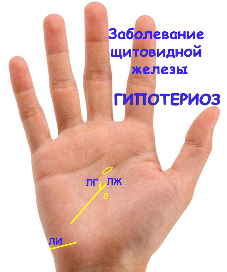 Признаки заболеваний четко отображены на руках