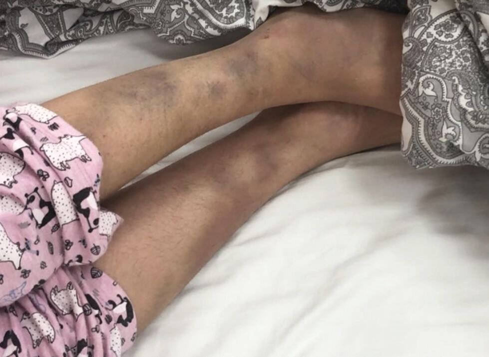 фото Максим из больницы "ШОУБИЗ - Закулисье"