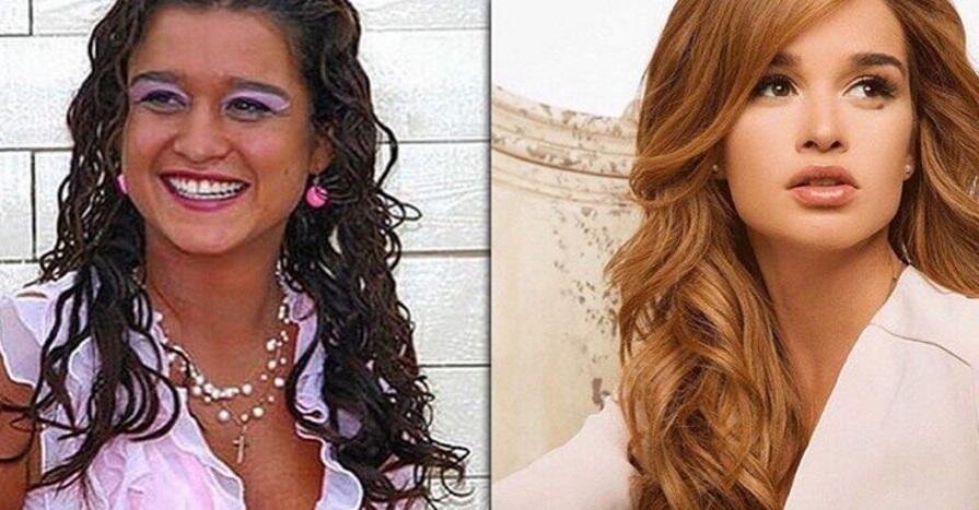 Ксения до пластики и после нее. Фотография с сайта https://vistanews.ru