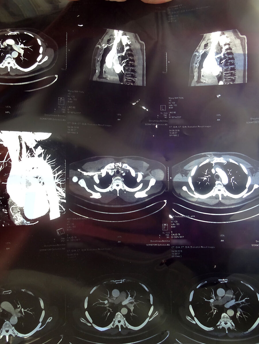 Томограмма. Забавно разглядывать себя изнутри