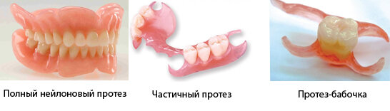 Источник: https://ozubkah.ru