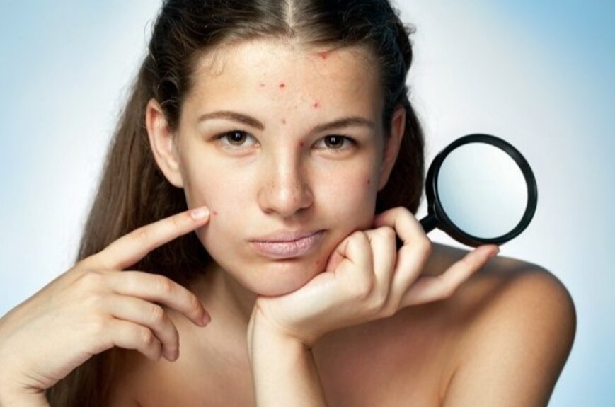 10 лет назад я ненавидела свое лицо