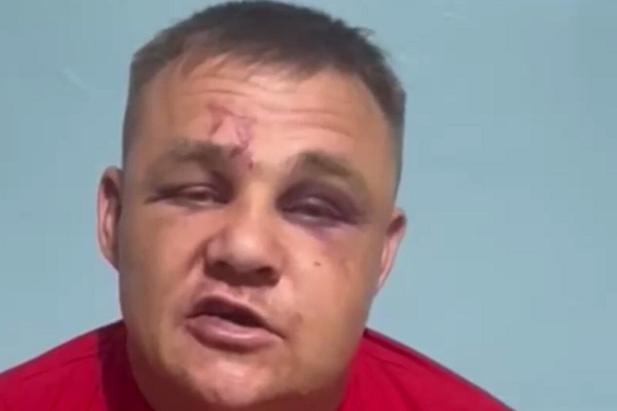 Зарубежные СМИ и правозащитники получили 15 фотографий избитых во время допросов в Нальчике людей