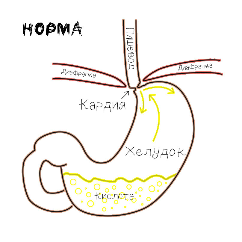 Народные средства от изжоги - способы, эффективность и противопоказания - FitoBlog