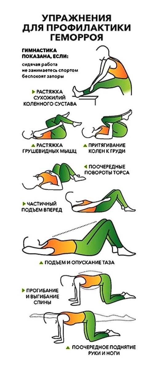 Геморрой 2 степени