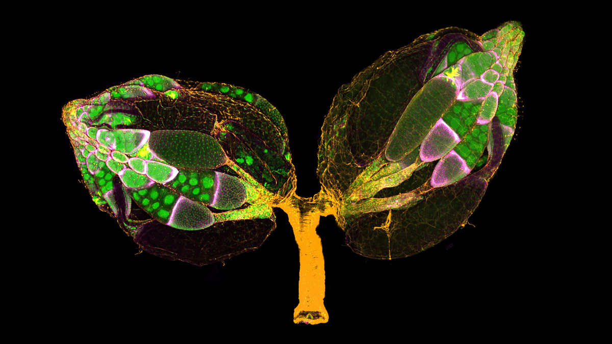 Яичники взрослой самки мухи-дрозофилы с окрашенным F-актином (желтым) и ядрами (зеленым); клетки фолликулов помечены флуоресцентным белком (красный цвет).

Dr. Yujun Chen Dr. Jocelyn McDonald