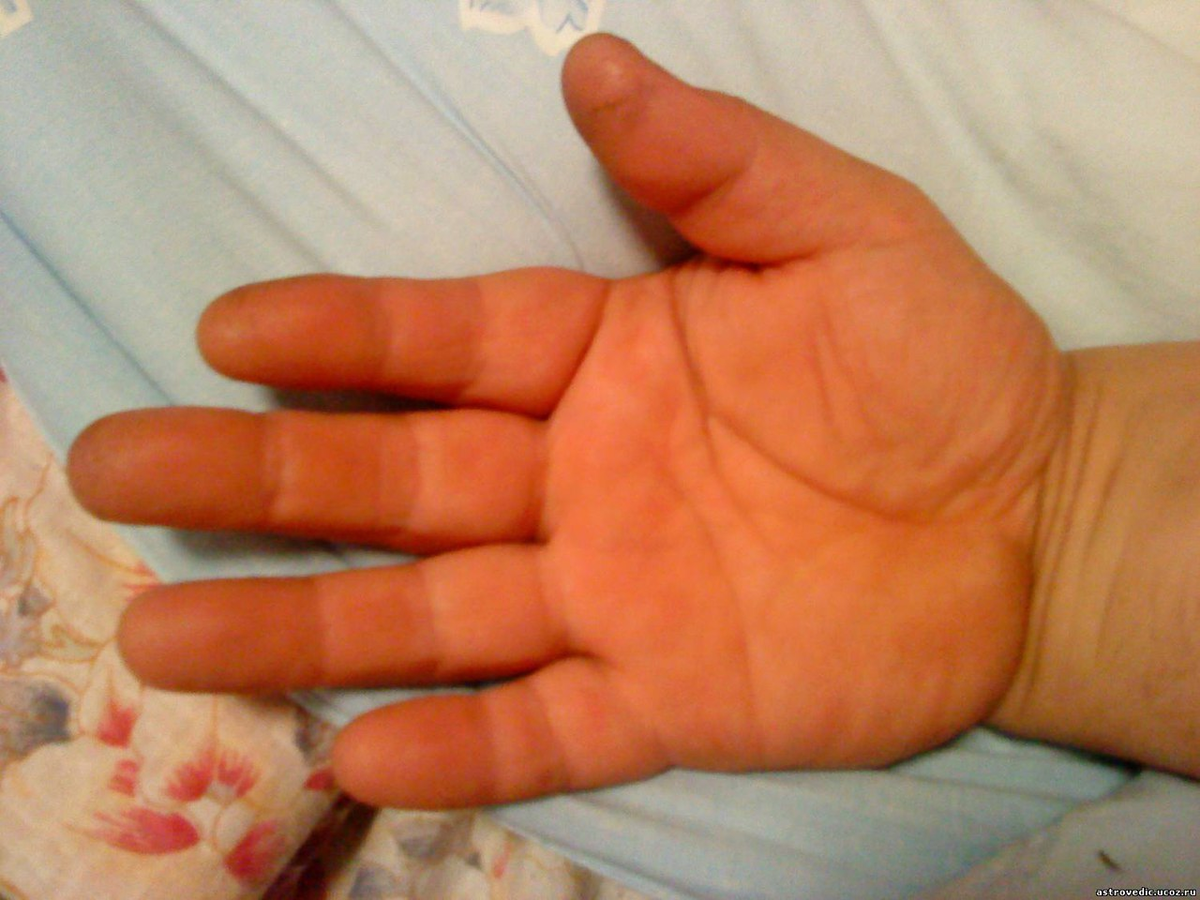 "Пустая" малоинформативная рука. 