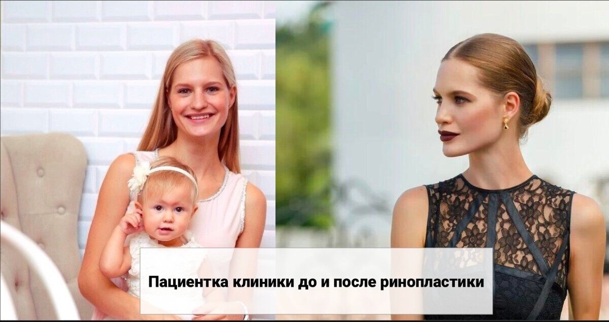 Фото из личного архива пациента 