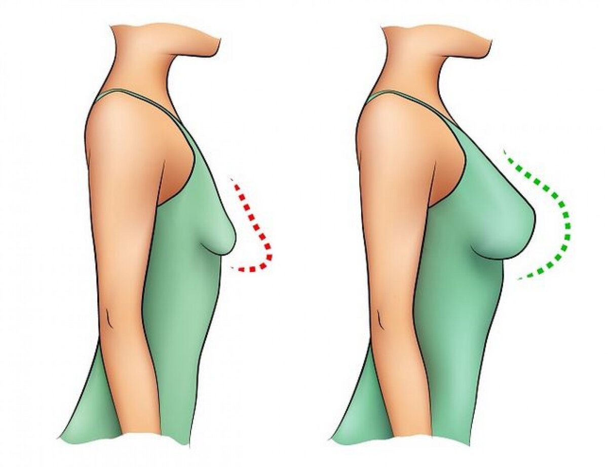 Похоже на мою ситуацию, но чуточку не так критично - сейчас и во время ГВ, из открытых источников 