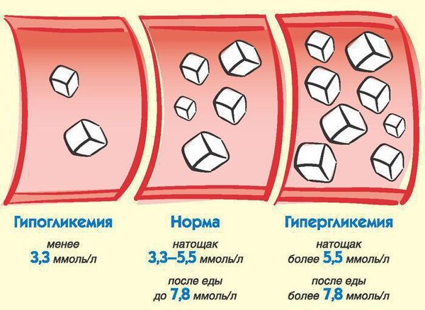 Сахар в крови - когда его нужно снижать, а когда можно этого не делать