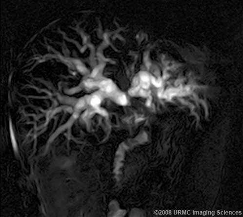 Результаты МРХПГ