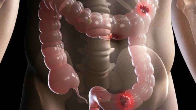 Источник: https://bit.ly/2IZdpG3