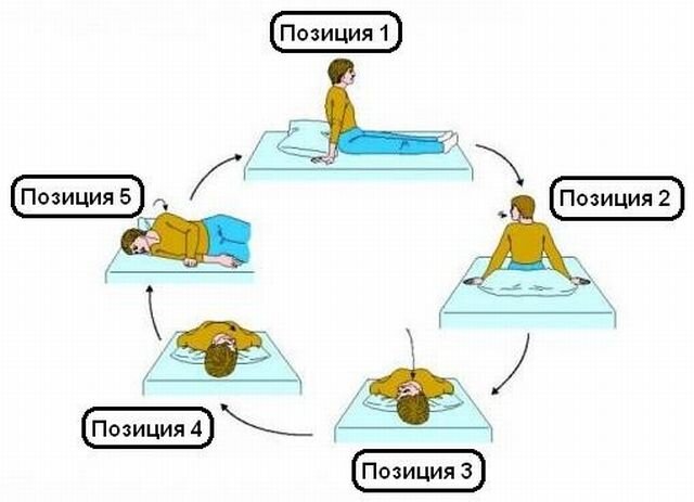 Упражнение Эпли для лечения головокружения при ДППГ.