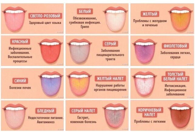 Язык карта организма