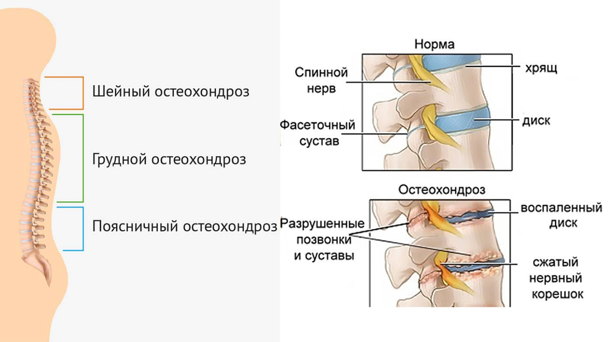 Популярный диагноз, которого на самом деле нет | Доктор Гульнара Мазитова |  Дзен