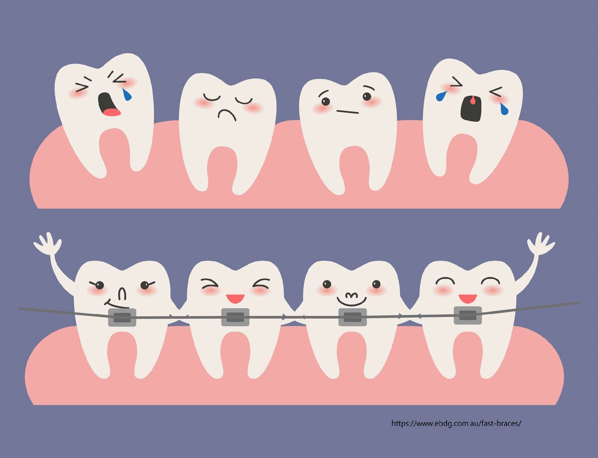 Картинки брекеты мультяшные