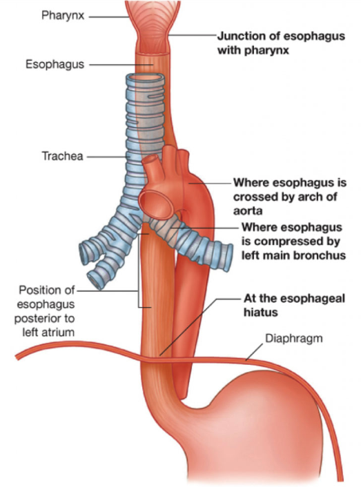 Сужения пищевода