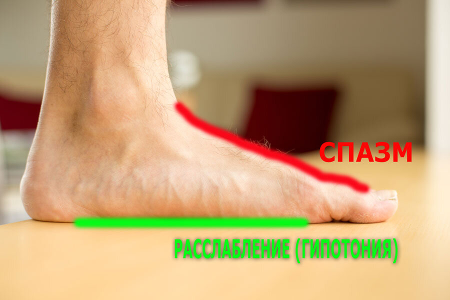 Искривляются пальцы рук. Как делать "растяжки" для большого пальца стопы. Тонкости, детали. Онемение пальцев рук: основные причины и методы лечения Опухают пальцы - Вопрос аллергологу - 03 Онлайн