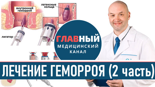 Геморрой у женщин: причины, симптомы, признаки, что делать, как избавиться, лечение