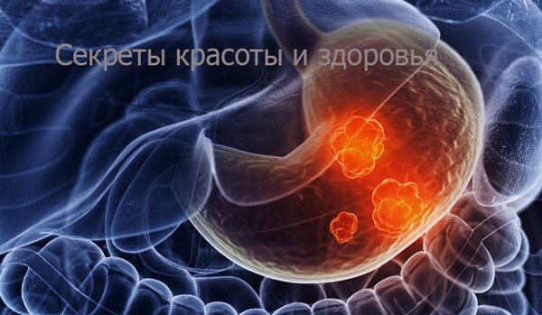 Источник: Гугл Картинки