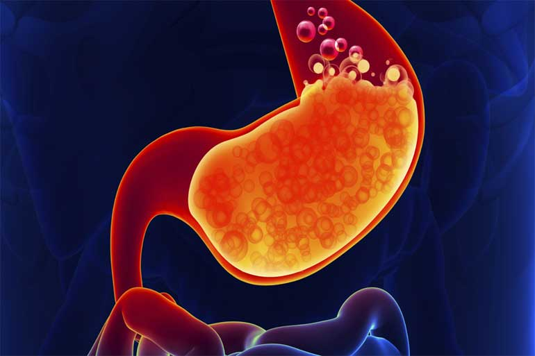 Истоочник: https://protrakt.ru 