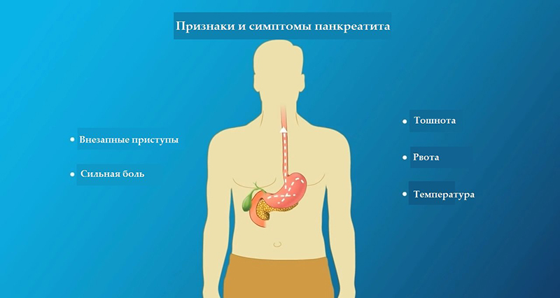 Боль поджелудочной железы симптомы