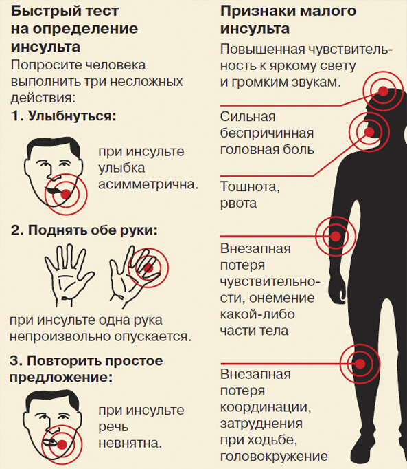 Инсульт что это такое и причины. Симптоматика инсульта. Инсульт симптомы. Симптомы прединсультного состояния. Состояние при инсульте симптомы.