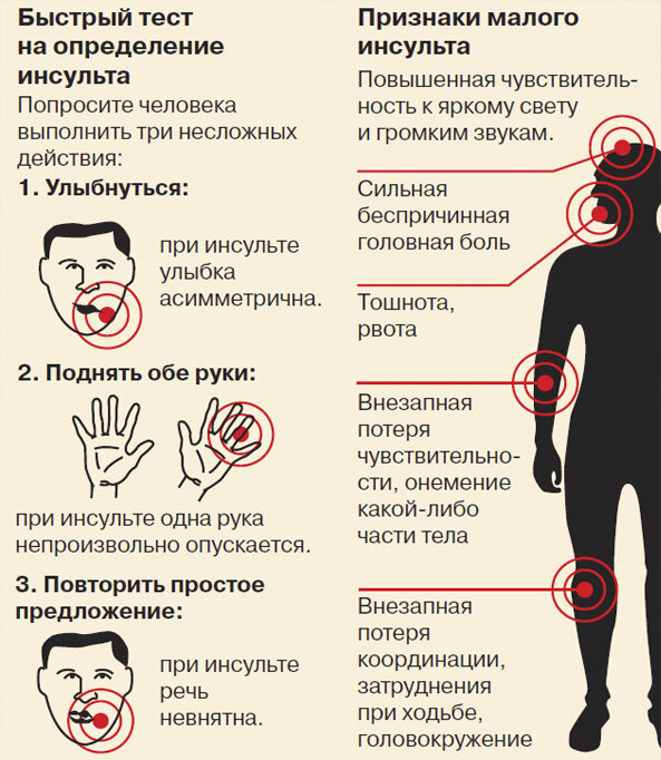 Прединсультные признаки у женщины