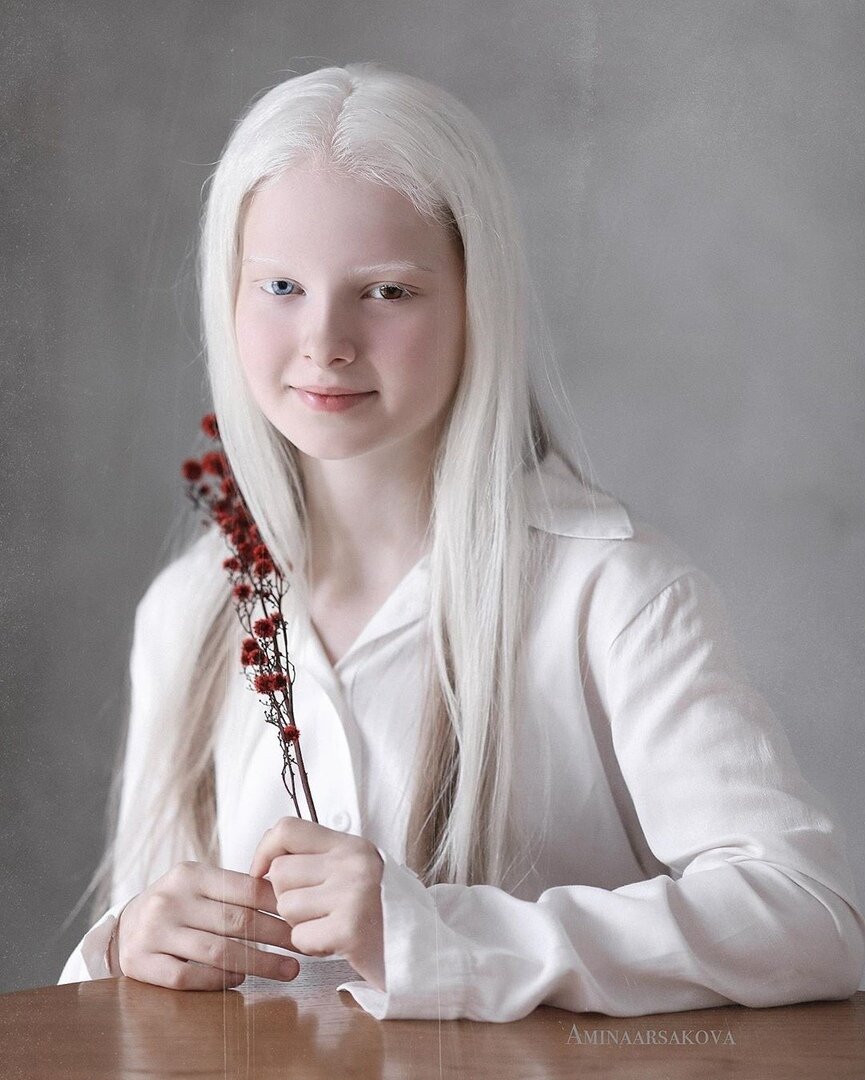 Девочка из Чечни - самая красивая альбинос. | Time to blossom. | Дзен