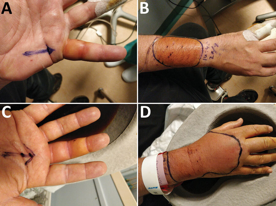   Nick K. Jones et al. / Emerging Infectious Diseases, 2023