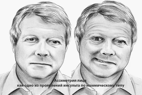 Знаете что тут не так? А вот тот кто перенес - знает!