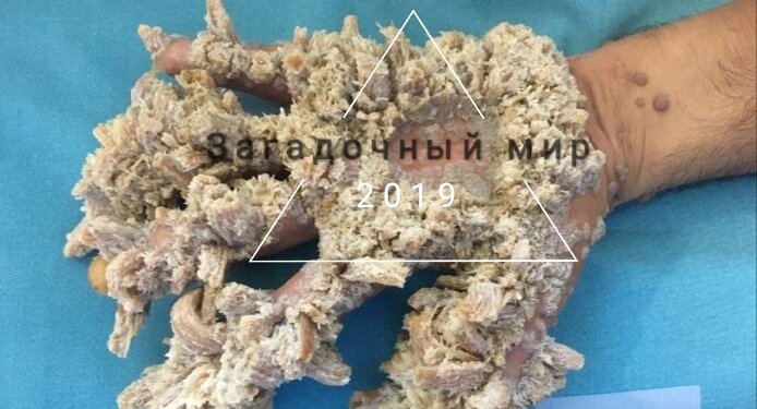 Загадки, болезнь, операция