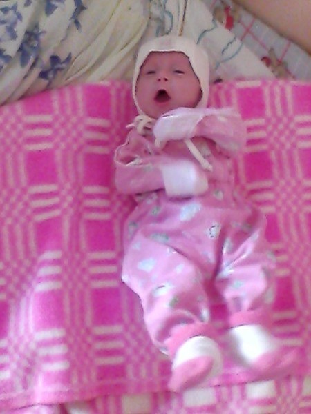 Такой Алису выписали домой: 4 месяца, вес 2600 г. 