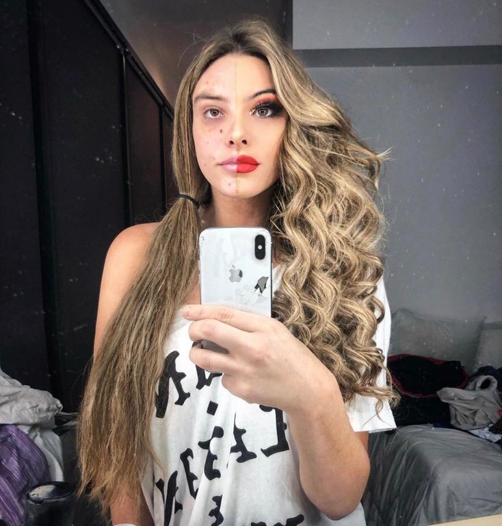 -2