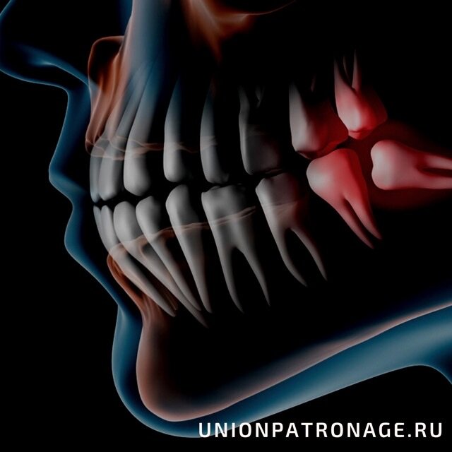 Фото взято из открытых источников 