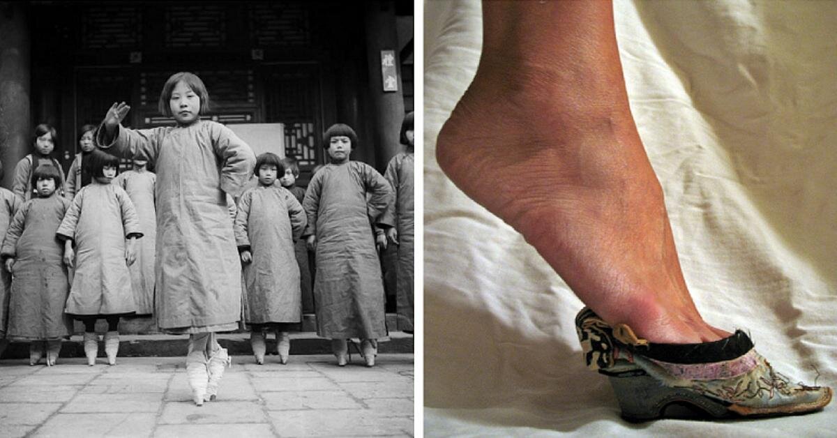 Ножки Лотоса