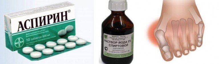 аспирин при подагре можно