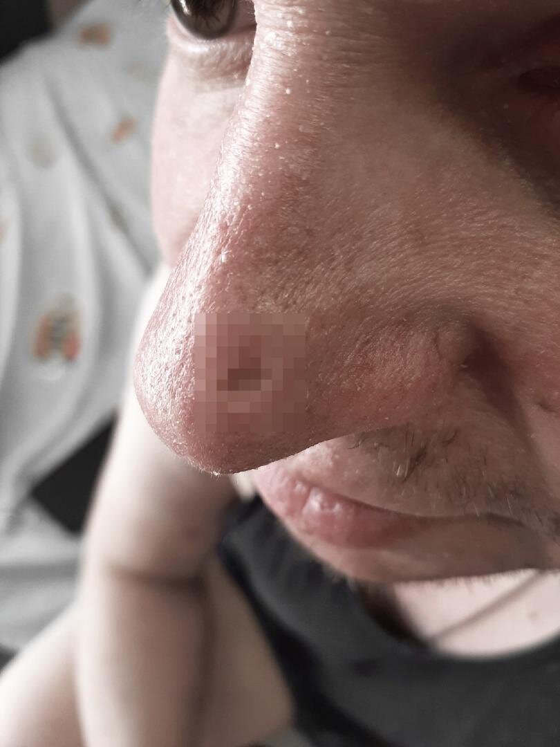 Реальное состояние "дыры"