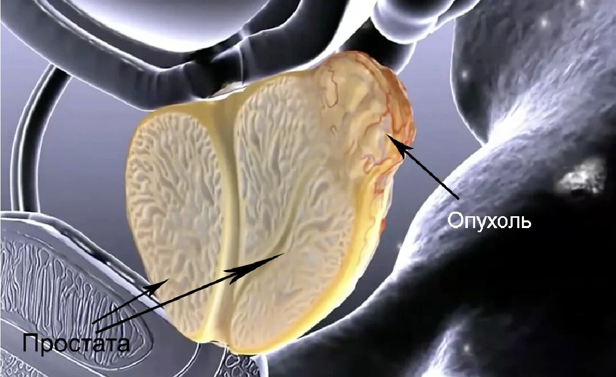 Предстательная железа, располагается прямо под мочевым пузырем.