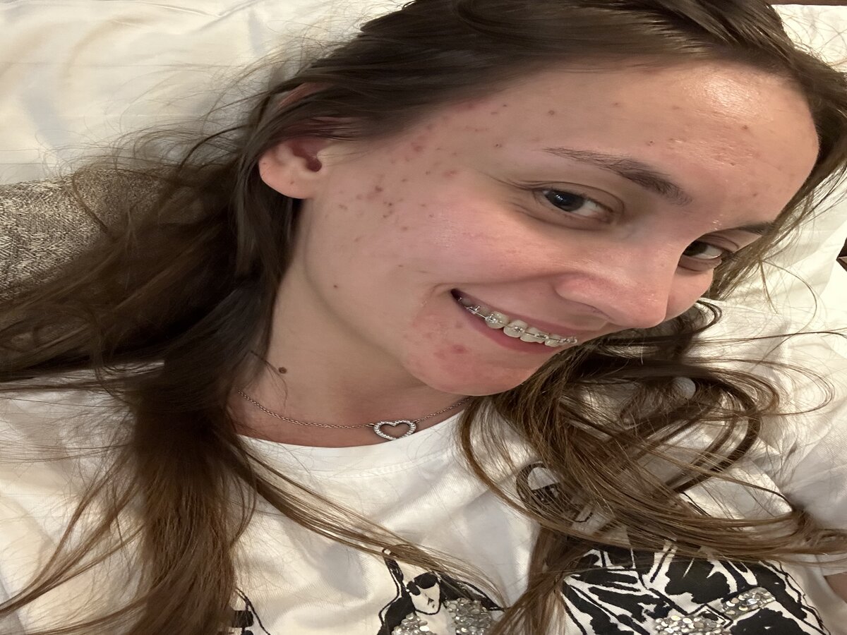 Так лицо выглядело месяц назад))