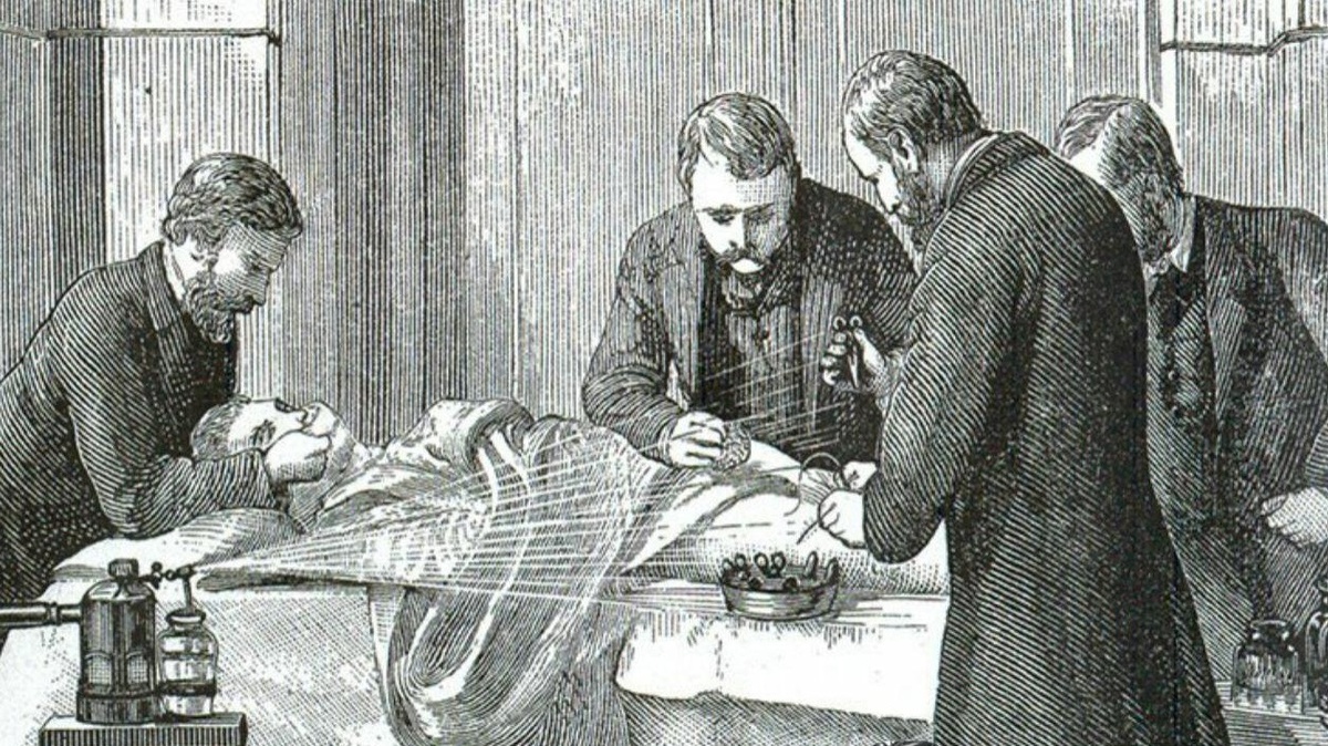   К 1860-м годам клитор обвинили в том, что он виновен в нравственной распущенности женщин. Они становятся склонны к истерии и психическим расстройствам и даже могут вести себя «неженственно». Да, врачи в те времена верили, что из-за клитора женщины ведут себя «неженственно». То есть «уклоняются от супружеского долга», «отдаляются от собственного мужа», проявляют агрессию и даже могут ответить колкостью мужу.