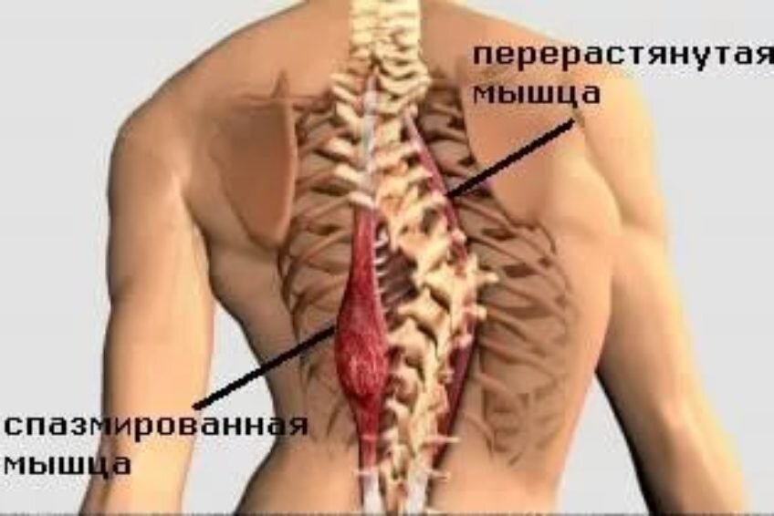 Основная проблема болей спины